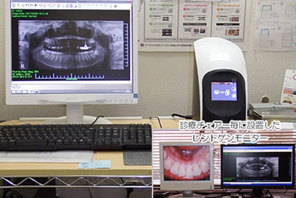 デジタルレントゲンシステム